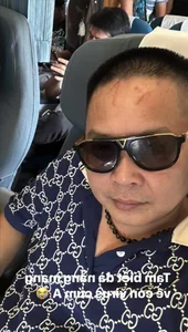 Singer Bao Thy’s Wealthy Husband Phan Linh Sparks Curiosity with Rare Selfie Showing Head Scars - image 6