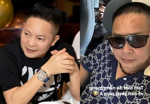 Singer Bao Thy’s Wealthy Husband Phan Linh Sparks Curiosity with Rare Selfie Showing Head Scars - image 3