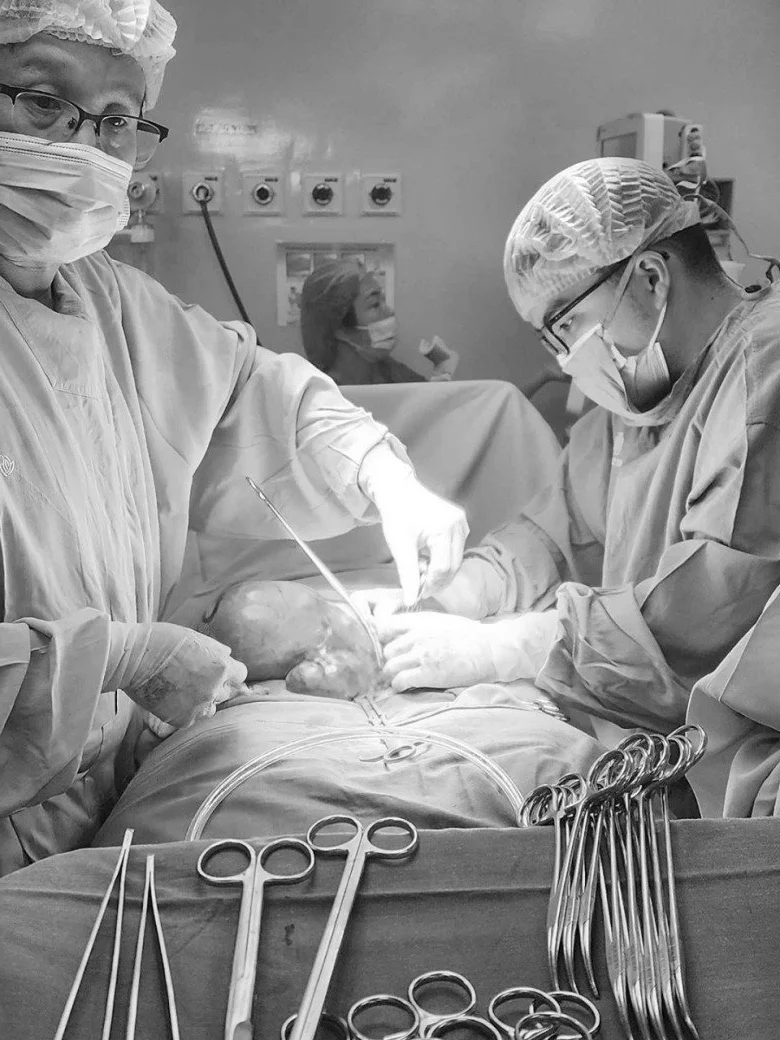 Mother Discovers Massive Four Kilogram Uterine Fibroid After Rapid Belly Growth