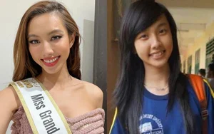 From Metal Braces to Crowned Queens: The Stunning Transformations of Y Nhi and Le Hoang Phuong - image 1
