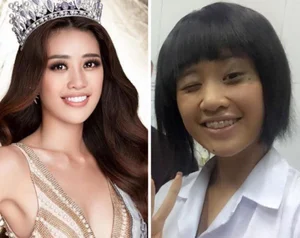 From Metal Braces to Crowned Queens: The Stunning Transformations of Y Nhi and Le Hoang Phuong - image 5