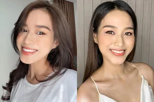 From Metal Braces to Crowned Queens: The Stunning Transformations of Y Nhi and Le Hoang Phuong - image 4