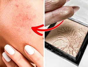 The Hidden Dangers of Viral Beauty Blogger Skincare Trends - image 6