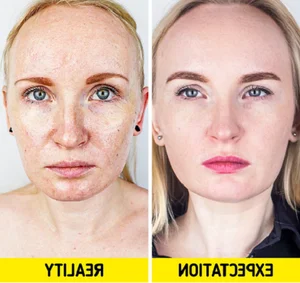 The Hidden Dangers of Viral Beauty Blogger Skincare Trends - image 9
