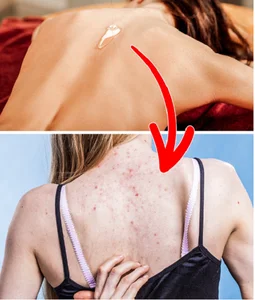 The Hidden Dangers of Viral Beauty Blogger Skincare Trends - image 7