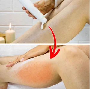 The Hidden Dangers of Viral Beauty Blogger Skincare Trends - image 5
