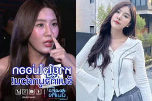 Singer Smile Parada Spends 343 Million VND to Fix Botched Nose Surgery - image 4