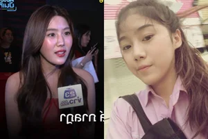 Singer Smile Parada Spends 343 Million VND to Fix Botched Nose Surgery - image 0
