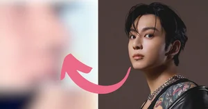 BTS Jungkook's Alleged Plastic Surgery Scars Spark Heated Online Debates - image 3