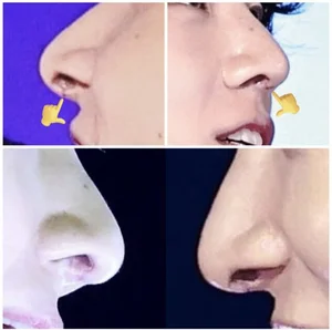 BTS Jungkook's Alleged Plastic Surgery Scars Spark Heated Online Debates - image 2
