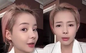 Ngan 98 Beauty Transformation Journey and 12 Nose Surgeries Analysis - image 7