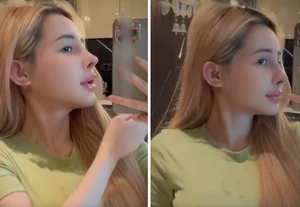 Ngan 98 Beauty Transformation Journey and 12 Nose Surgeries Analysis - image 8