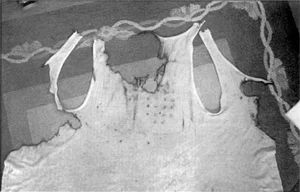The Mysterious UFO Encounter: A Close Contact Resulting in Physical Burns - image 0