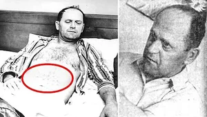 The Mysterious UFO Encounter: A Close Contact Resulting in Physical Burns - image 4