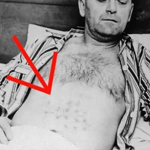 The Mysterious UFO Encounter: A Close Contact Resulting in Physical Burns - image 3