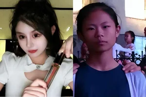 A Cautionary Tale: The Regret of a Young Plastic Surgery Addict - image 3
