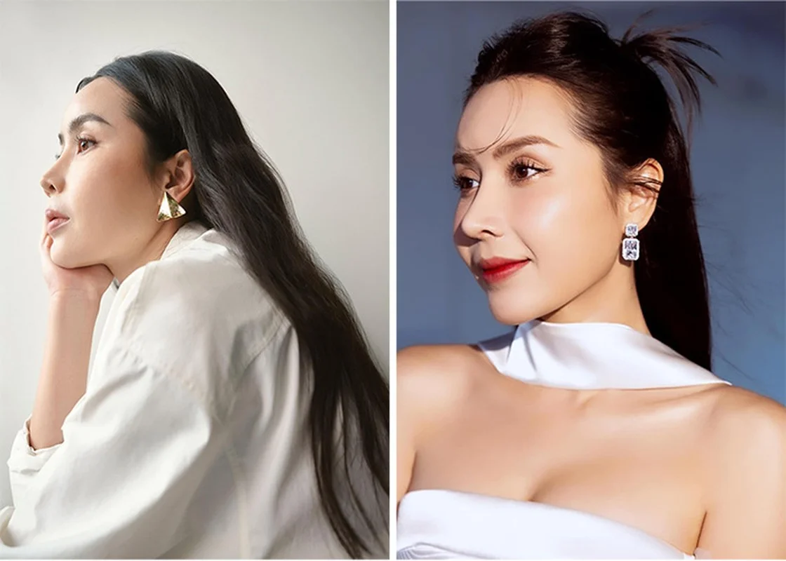 Luu Huong Giang Embraces Her Radiance and Confidence After Cosmetic Enhancements