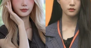 Popular K-Pop Idol Sparks Plastic Surgery Rumors with Unrecognizable New Look - image 2
