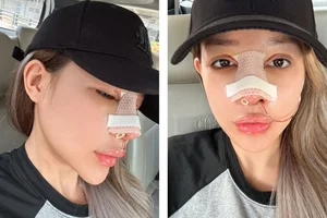 Ngan 98 and the Controversy of Plastic Surgery: Why She Keeps Redefining Her Look - image 9