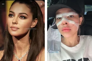Ngan 98 and the Controversy of Plastic Surgery: Why She Keeps Redefining Her Look - image 8