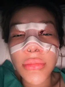 Ngan 98 and the Controversy of Plastic Surgery: Why She Keeps Redefining Her Look - image 0