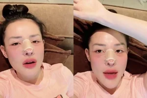 Ngan 98 and the Controversy of Plastic Surgery: Why She Keeps Redefining Her Look - image 7