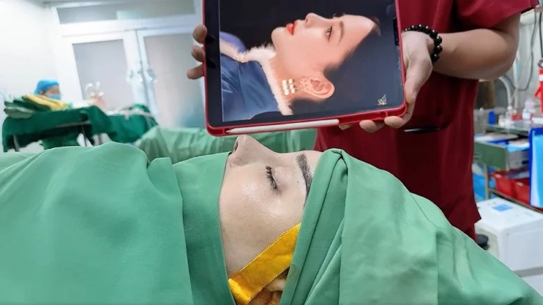 Lâm Khánh Chi’s Continuing Plastic Surgery Journey: Investing in Beauty and Confidence in Her Late 40s