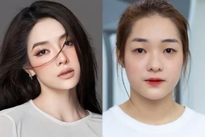 Miss Grand Vietnam 2023: The Plastic Surgery Transformation Journey - image 1