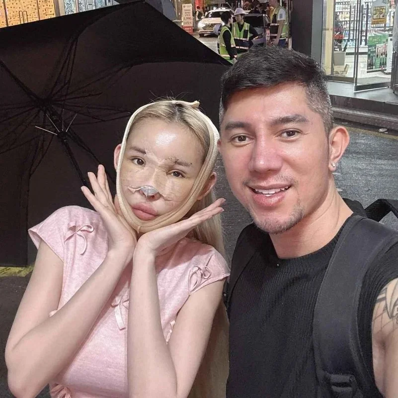 Ngan 98 Plastic Surgery Journey: Exploring the Costs and Transformations of the Famous Vietnamese Influencer