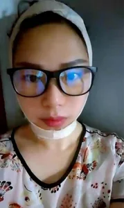 Unrecognizable Transformation: 47-Year-Old Woman Returns Home After Secret Cosmetic Surgery - image 2