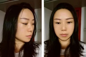 Unrecognizable Transformation: 47-Year-Old Woman Returns Home After Secret Cosmetic Surgery - image 1