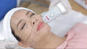Unrecognizable Transformation: 47-Year-Old Woman Returns Home After Secret Cosmetic Surgery - image 0