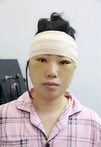 Unrecognizable Transformation: 47-Year-Old Woman Returns Home After Secret Cosmetic Surgery - image 6