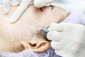 Unrecognizable Transformation: 47-Year-Old Woman Returns Home After Secret Cosmetic Surgery - image 4