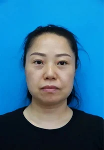 Unrecognizable Transformation: 47-Year-Old Woman Returns Home After Secret Cosmetic Surgery - image 3