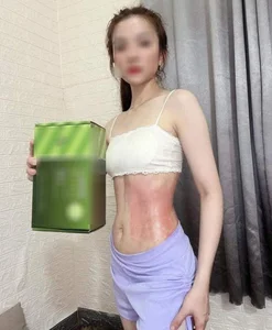 Top 5 Dangerous Social Media Beauty Trends You Should Avoid - image 1