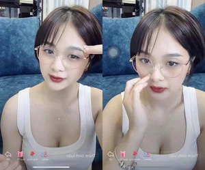 Ngỡ ngàng trước diện mạo mới của 'thánh nữ bi a' Gấm Kami sau phẫu thuật thẩm mỹ - image 0