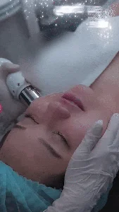 Trúc Anh Mắt Biếc Beauty Update: Post-Facelift Transformation and Career News - image 1