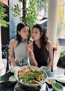 Vietnamese Star News: Dam Vinh Hung Undergoes Surgery and Thuy Tien TikTok Clip Sparks Online Buzz - image 29