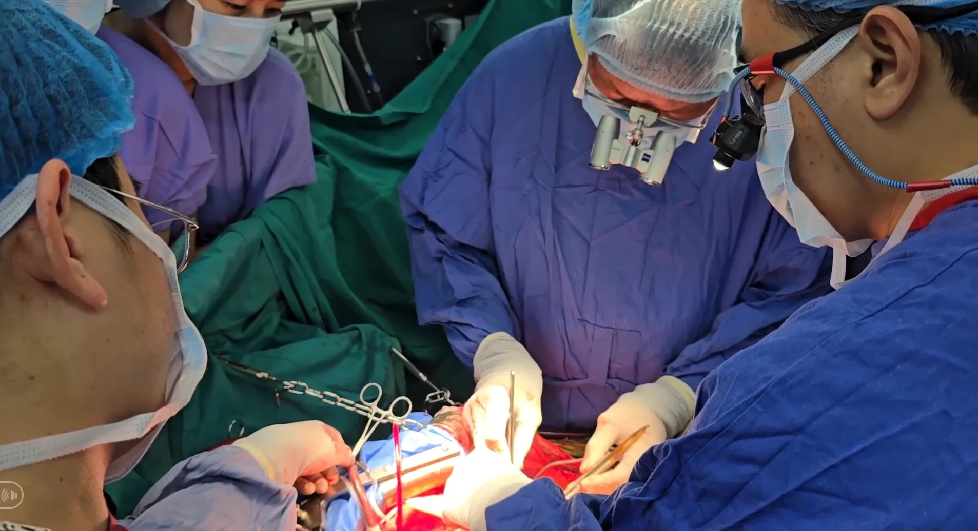 Vietnamese Medical Miracle: The Historic Success of the First Domino Organ Transplant