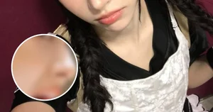 Popular Female HYBE Idol Faces Plastic Surgery Allegations and Fan Debates - image 0
