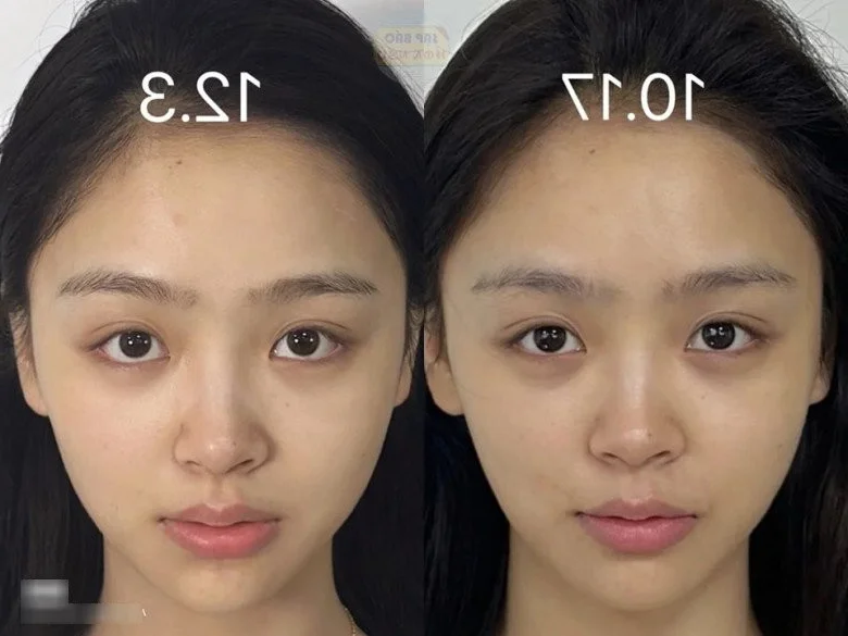 Zero-Cost Skincare Routine: How This Simple Habit Revitalized Her Skin