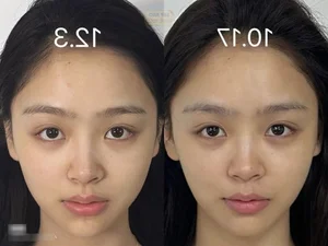 Zero-Cost Skincare Routine: How This Simple Habit Revitalized Her Skin - image 0
