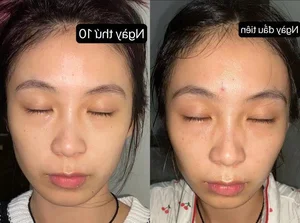 Zero-Cost Skincare Routine: How This Simple Habit Revitalized Her Skin - image 1