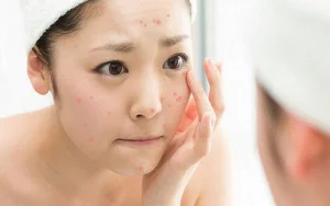 Zero-Cost Skincare Routine: How This Simple Habit Revitalized Her Skin - image 7