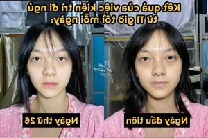 Zero-Cost Skincare Routine: How This Simple Habit Revitalized Her Skin - image 5