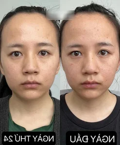 Zero-Cost Skincare Routine: How This Simple Habit Revitalized Her Skin - image 9