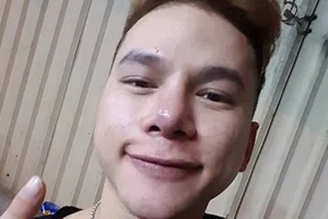Cosmetic Surgery Risks: Vietnamese Celebrities Share Complications After Nose Jobs - image 5