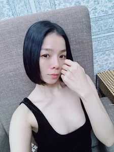 Cosmetic Surgery Risks: Vietnamese Celebrities Share Complications After Nose Jobs - image 1