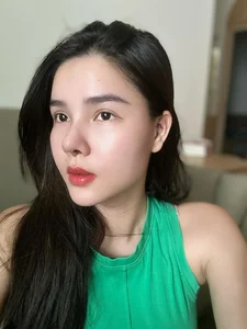 Cosmetic Surgery Risks: Vietnamese Celebrities Share Complications After Nose Jobs - image 4